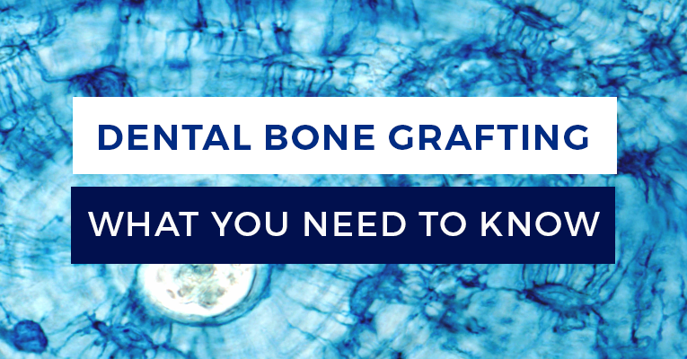 bone grafting 